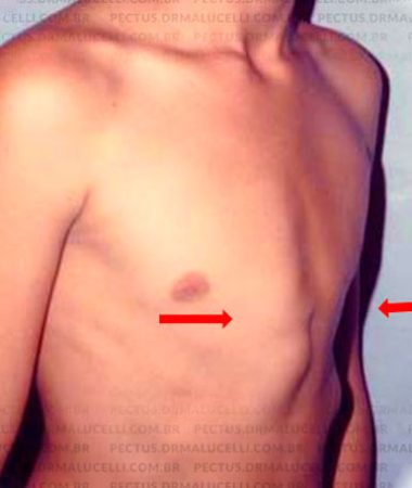 dr_malucelli_imagem_casos_pacientes_antes